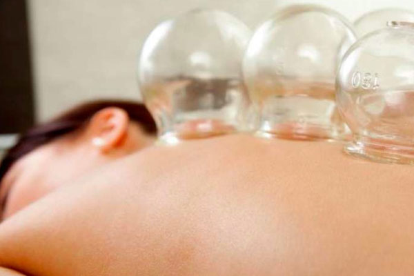 acupuncture-ventouses-liege