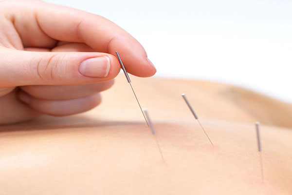 centre acupuncture liege